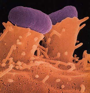 Az ember vastagbelében él baktérium