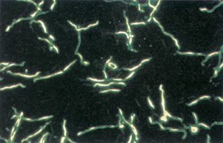 Csavart alakú baktériumok